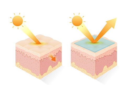 Incanthera -Sol -UV-Rays -Image